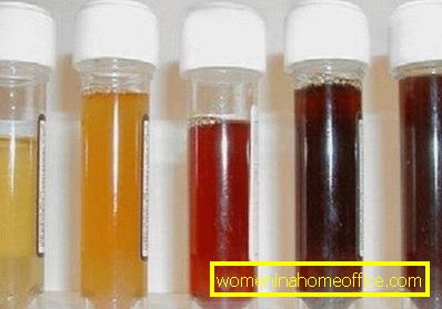 Hvorfor urin endrer fargen etter å ha spist rødbeter